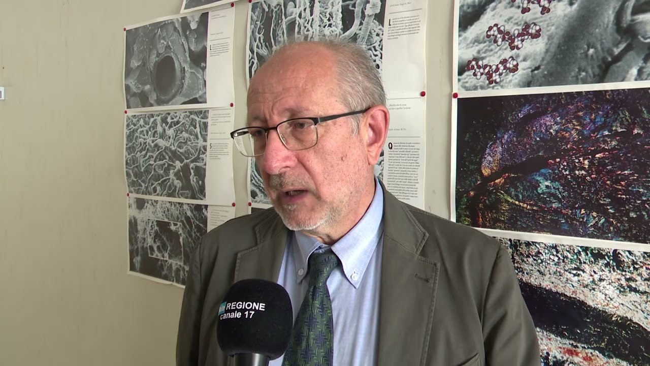 Carabellese revoca dimissioni ma l’Asrem avvia procedure per la sostituzione – 30/11/2025